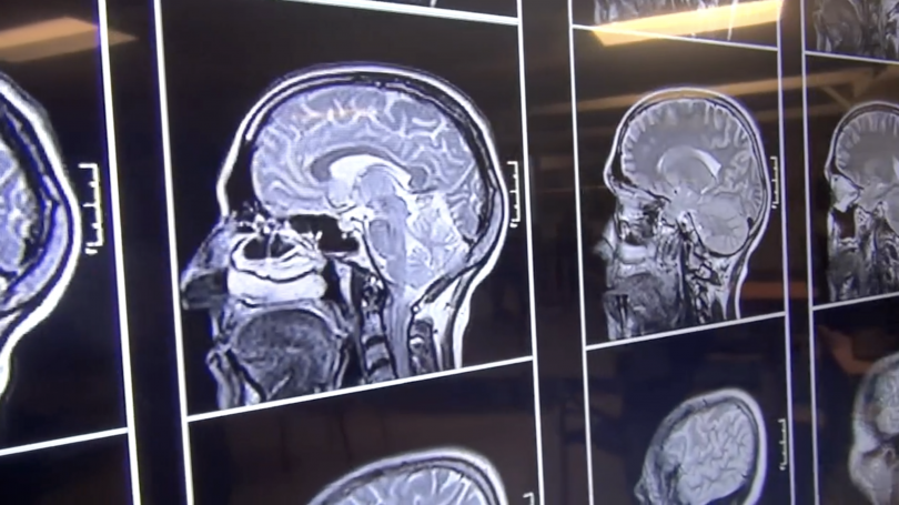 Cognitive Assessment & Diagnostic (CAD) Pathway